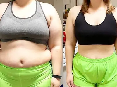 KetoVera real customer testimonial before and after photo